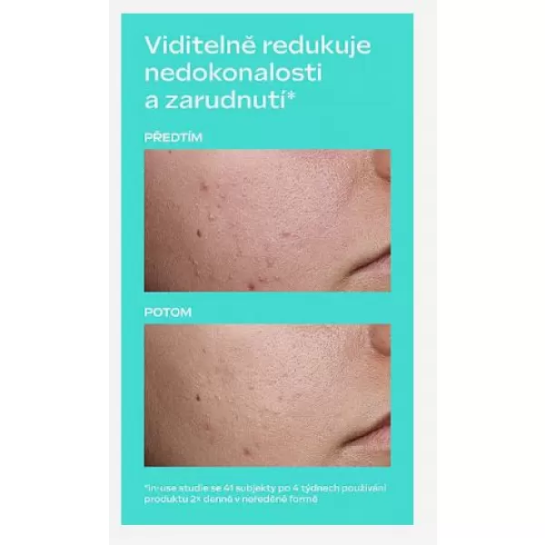 Weleda Clear & Pure Skin Serum Booster Drops 30 ml